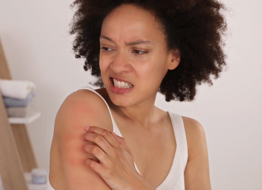 Is Eczema A Sign Of A Weak Immune System?