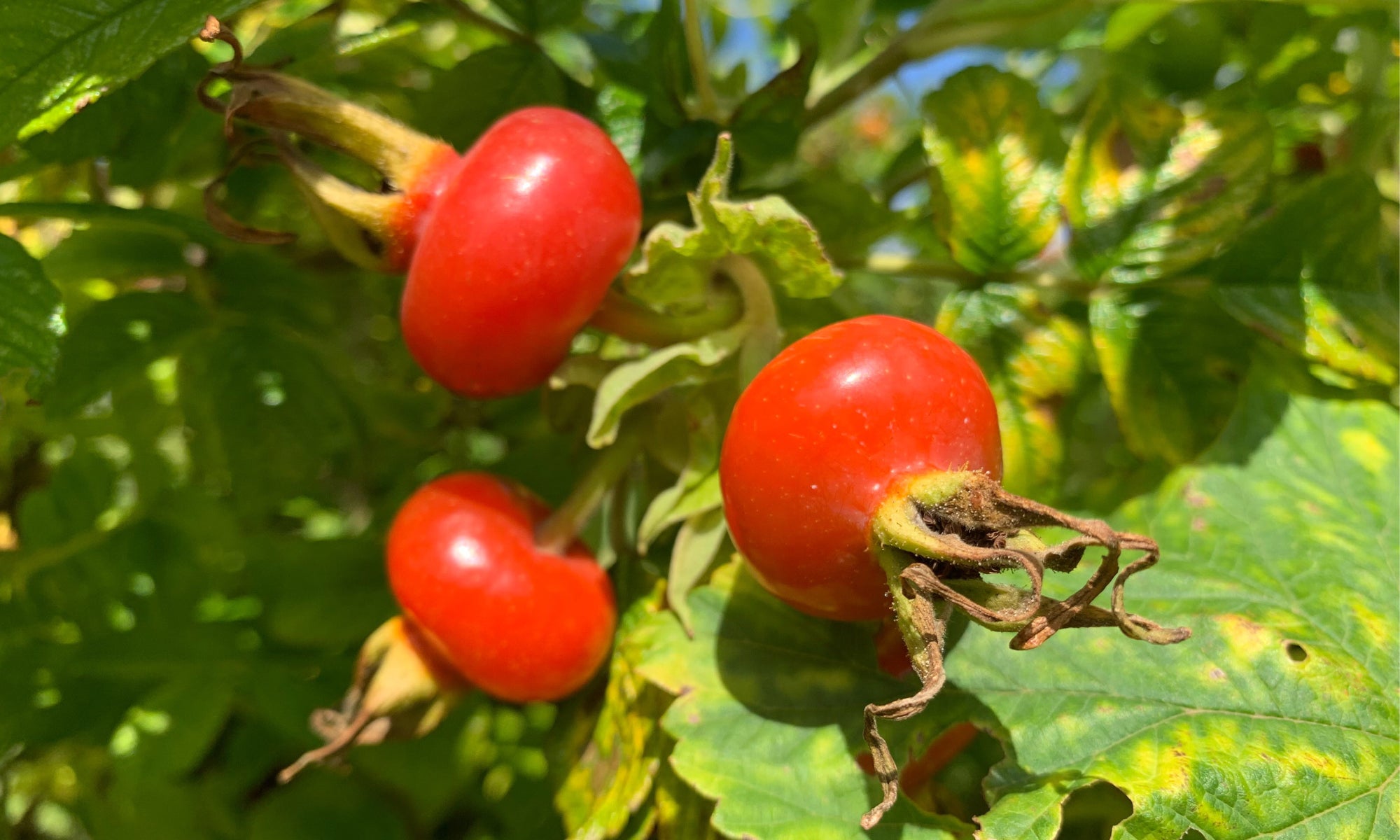 Is Rosehip Oil Good For Perioral Dermatitis?