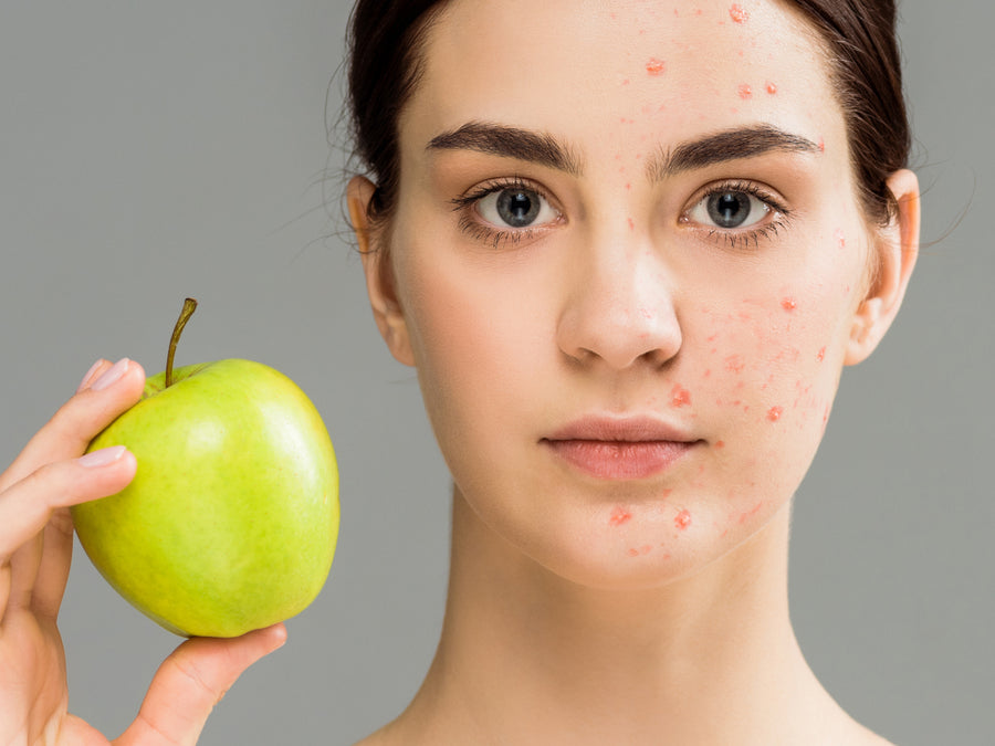 How Long Does It Take For Diet To Affect Skin?