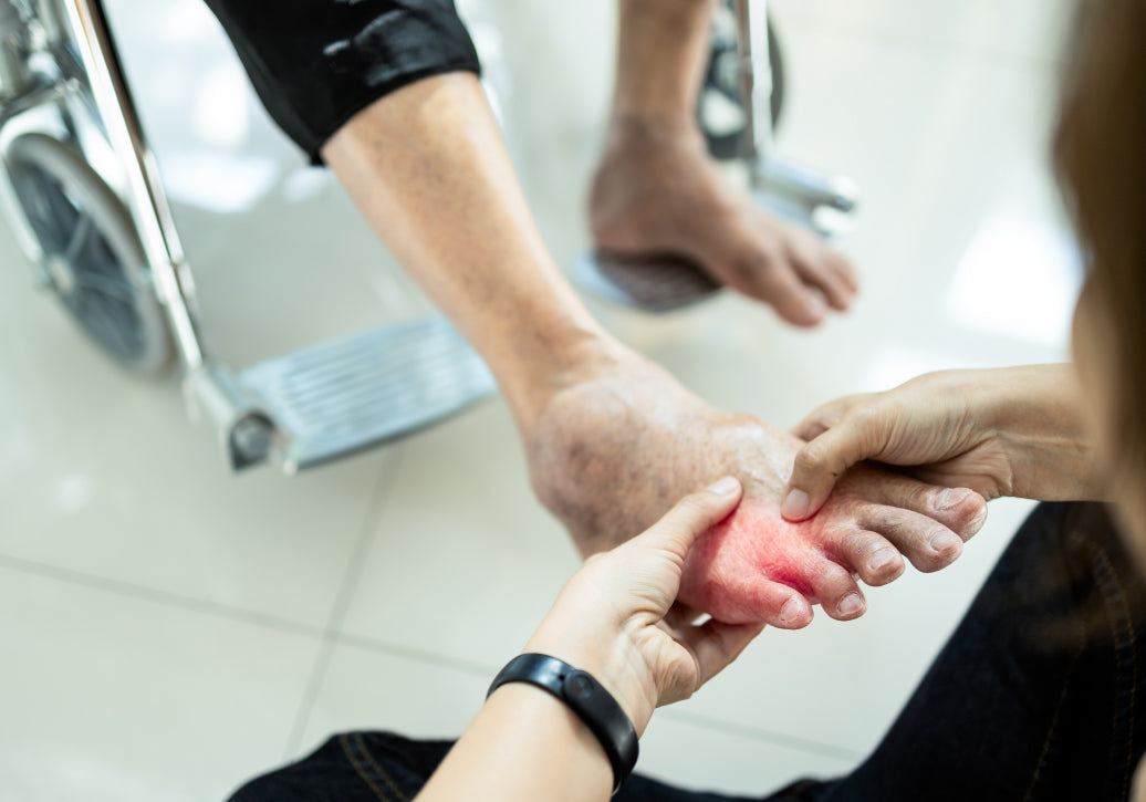 a foot being examined for dermatitis