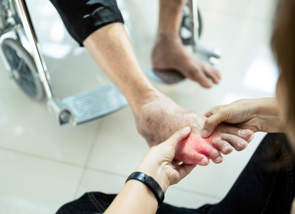 a foot being examined for dermatitis