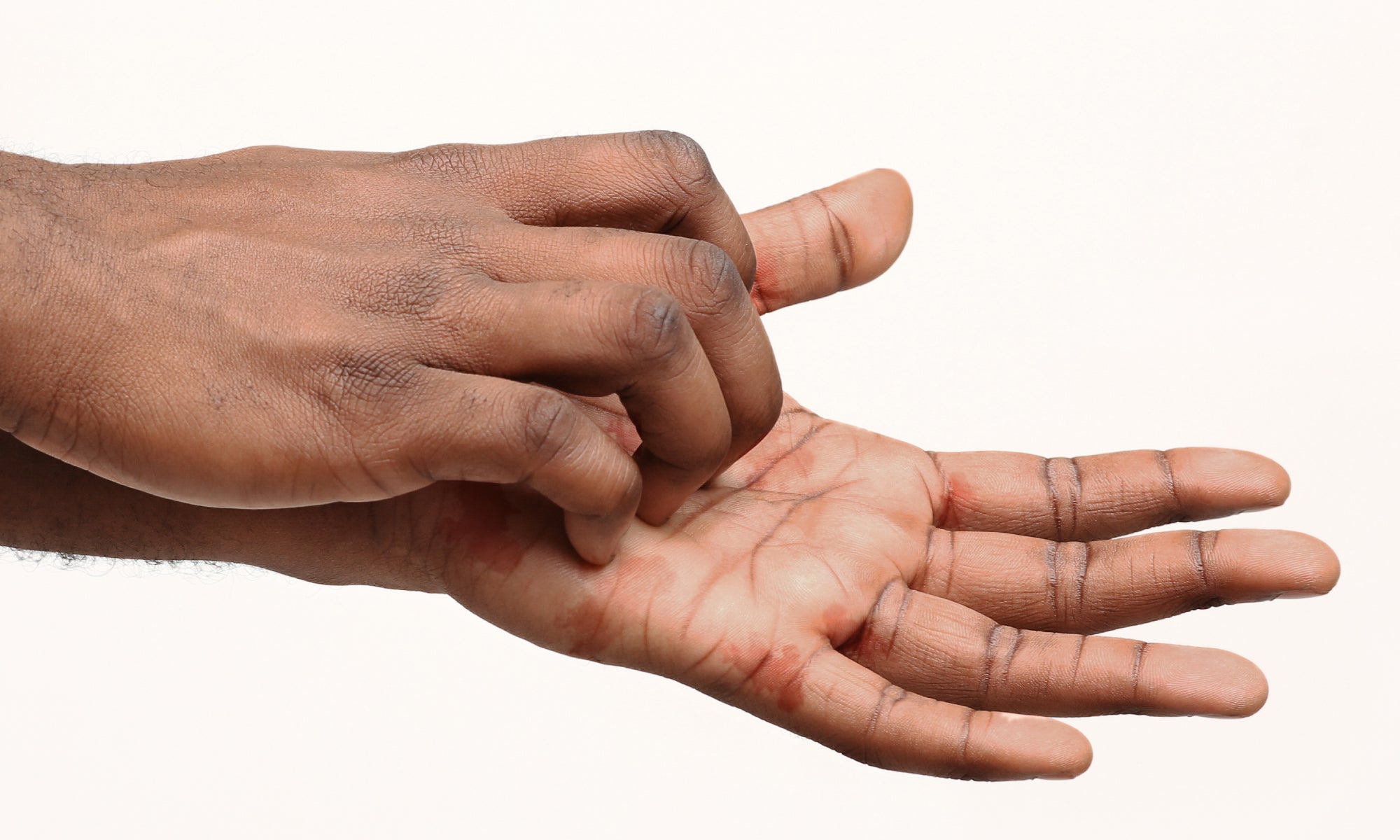 Best Hand Cream For Cracked, Red-Raw, Sore Hands