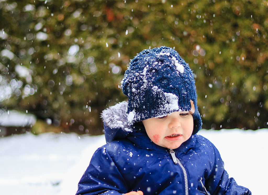 Does Winter Make Perioral Dermatitis Worse?