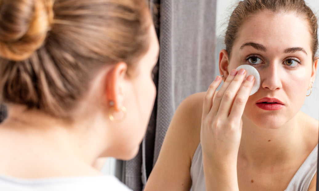 How Do You Prevent Blepharitis?