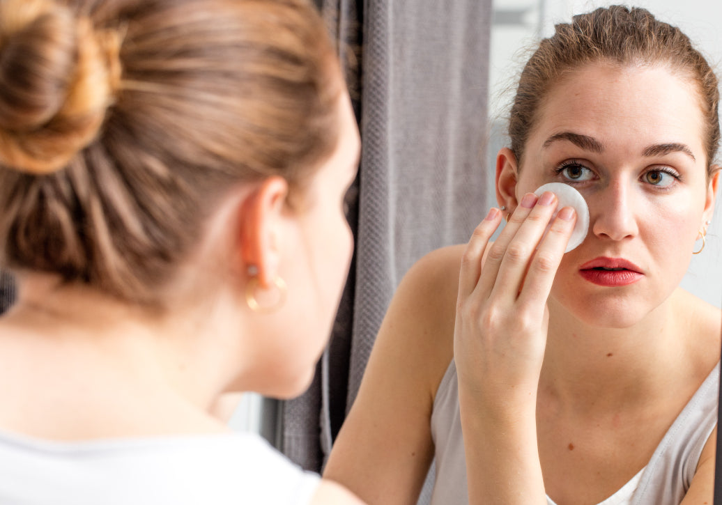 How Do You Prevent Blepharitis?
