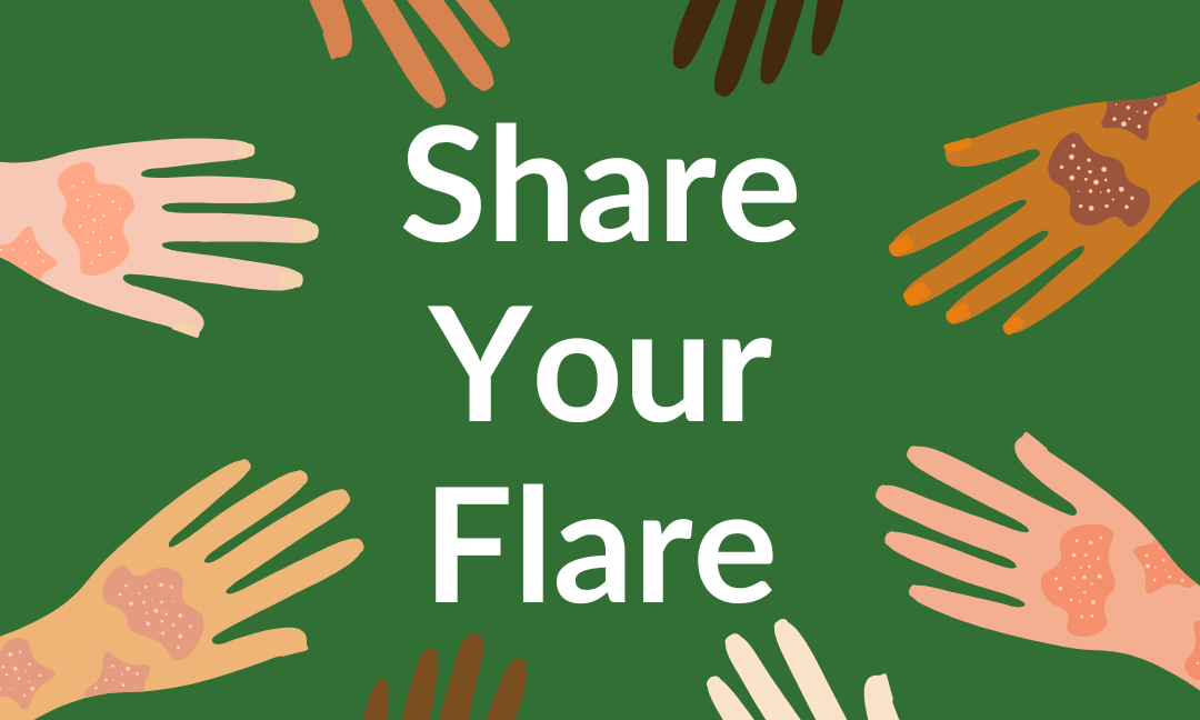 #ShareYourFlare Campaign