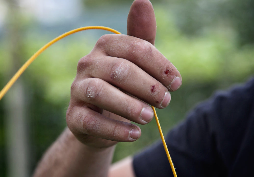 A climber holding some thin rope, showing grazes and marks on hands