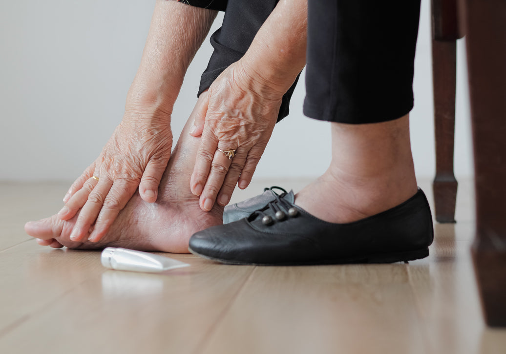 What Is The Best Treatment For Stasis Dermatitis?