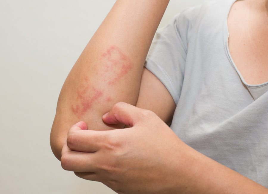 What’s Usually The First Sign Of Dermatitis?