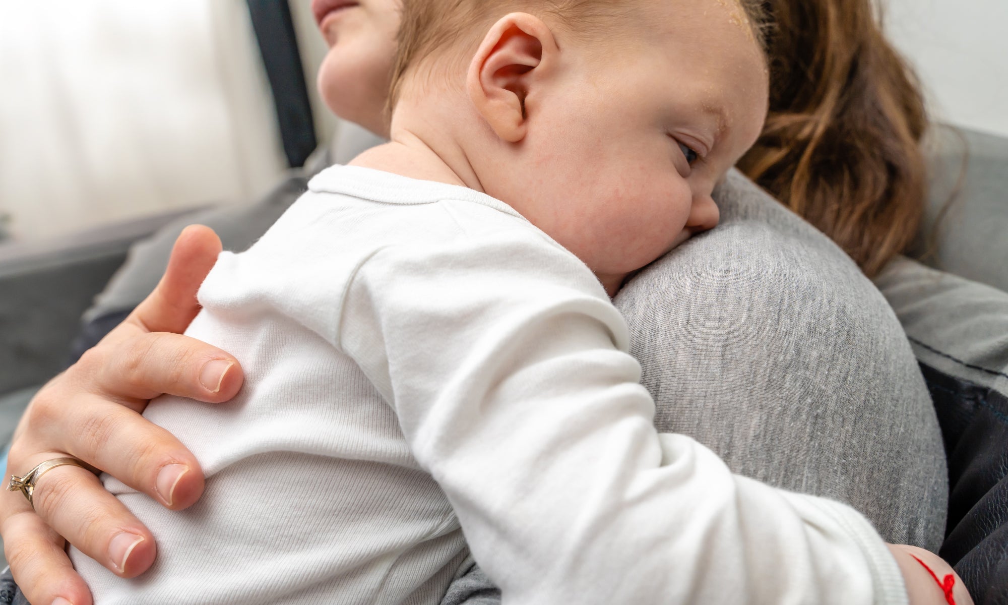 How Do I Know If My Baby Has Topical Steroid Withdrawal Syndrome?