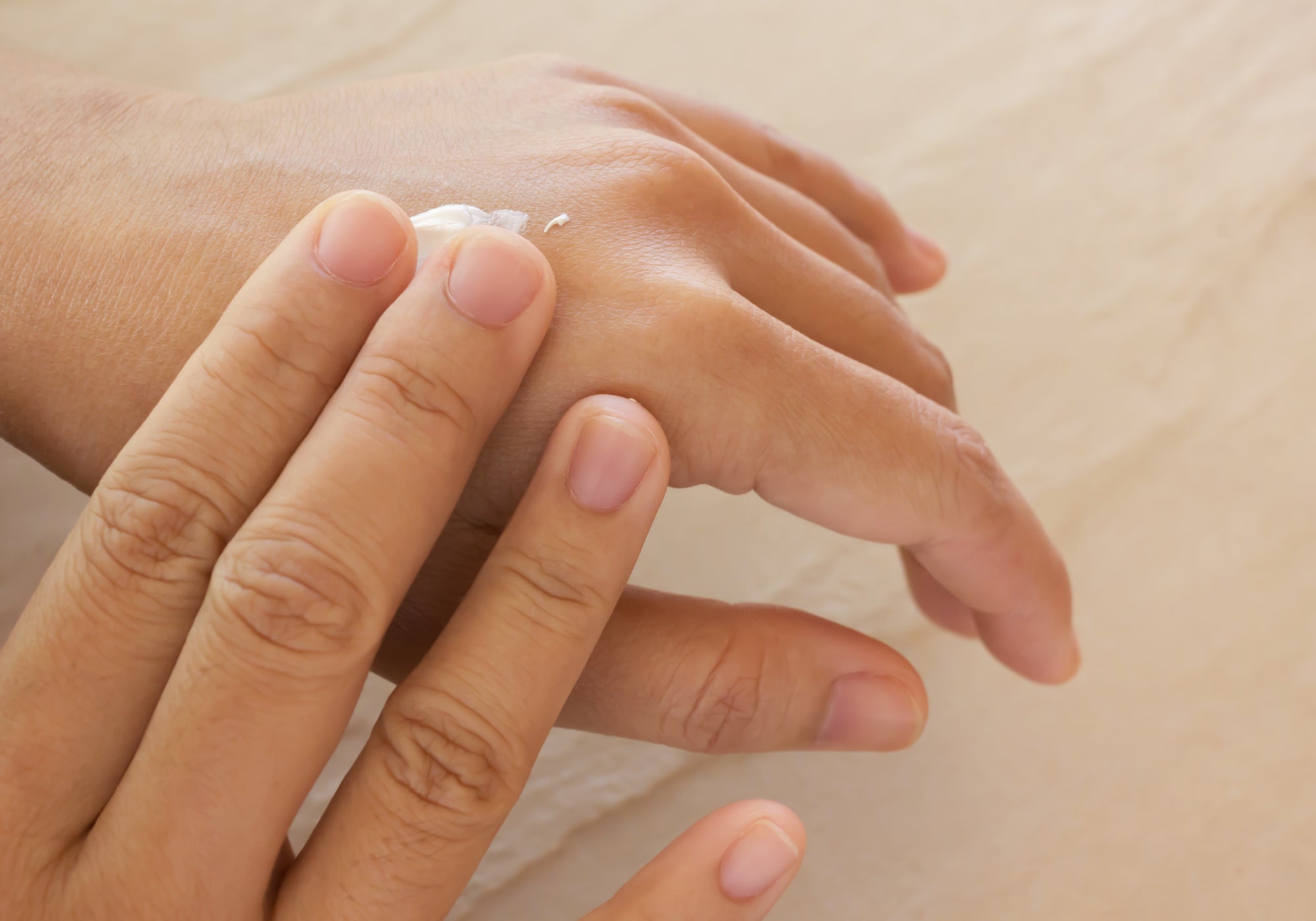 What's The Best Lotion For Ichthyosis?