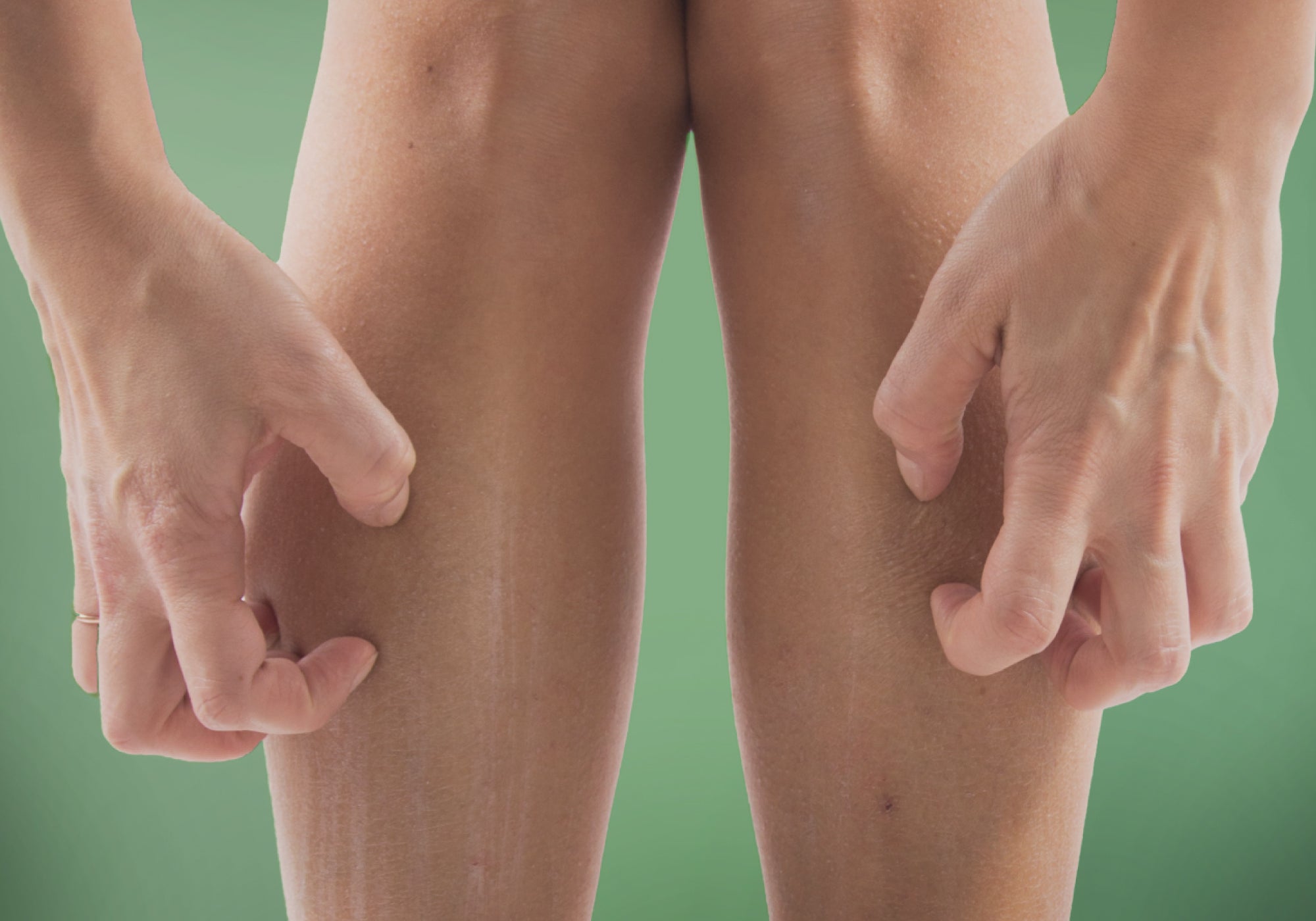 6 Common Causes Of Itchy Lower Legs