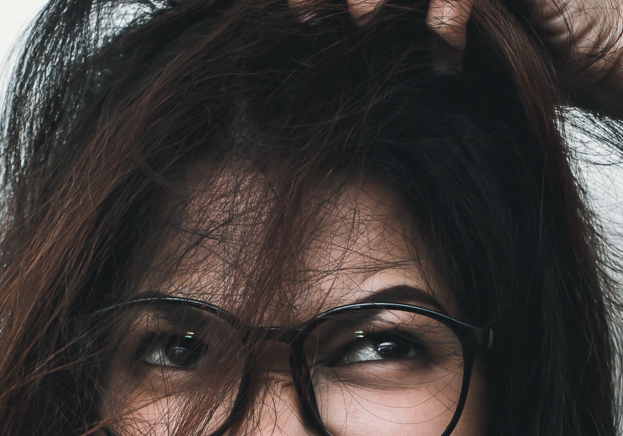Is Seborrheic Dermatitis A Fungus?