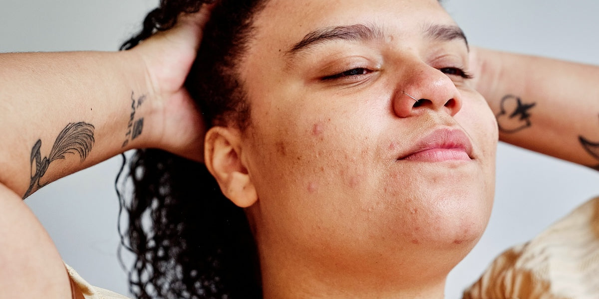 woman with natural skin reflecting impacts of stress and the mind body connection