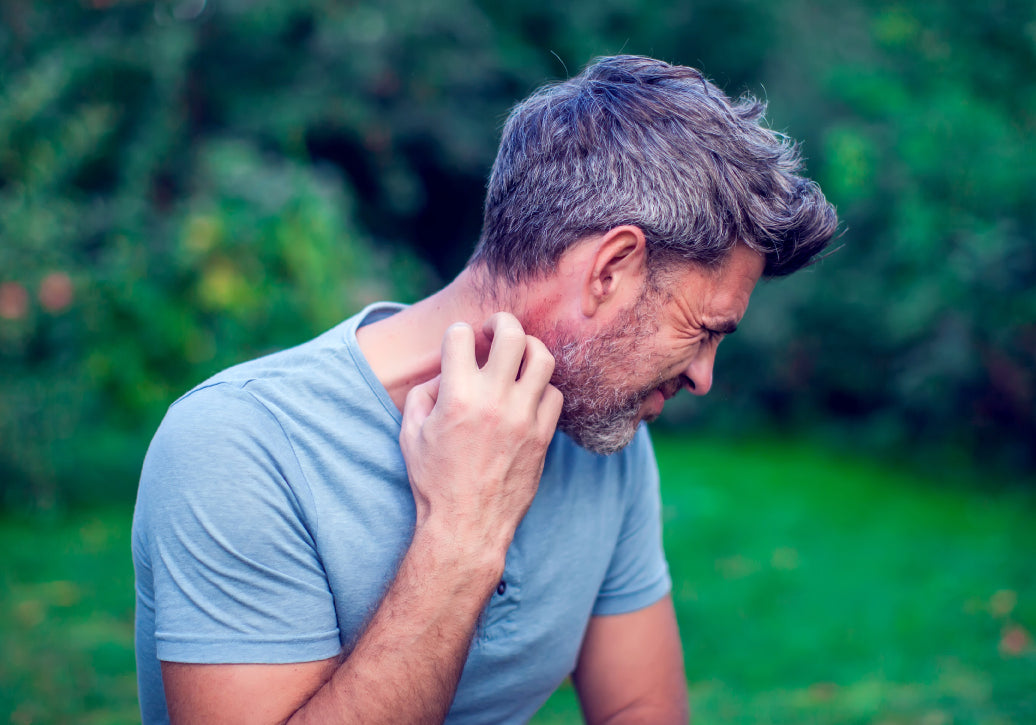 Why Is Dermatitis Itchy?